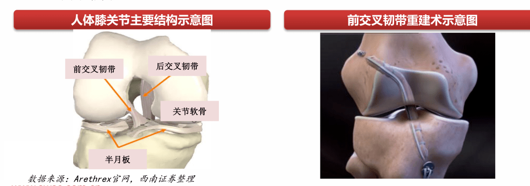 膝關節結構 膝關節結構